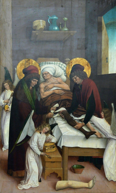 Legendary transplantation of a leg by Saints Cosmas and Damian, assisted by angels by Meister des Stettener und Schnaiter Altarretabels
