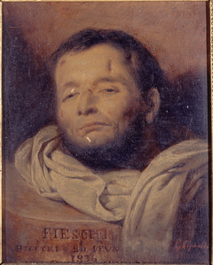Tête de Giuseppe Fieschi (1790-1836), après son exécution